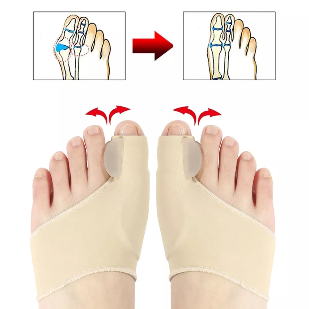 Daytime Bunion Sleeve: alternate color or angle