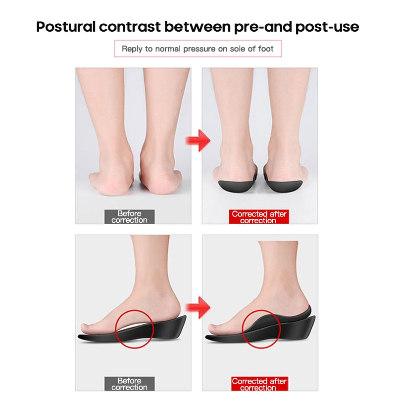 Flat Foot Orthopedic Insoles: top view