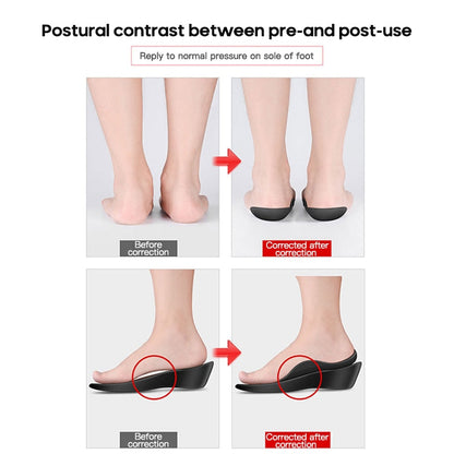 Flat Foot Orthopedic Insoles: top view