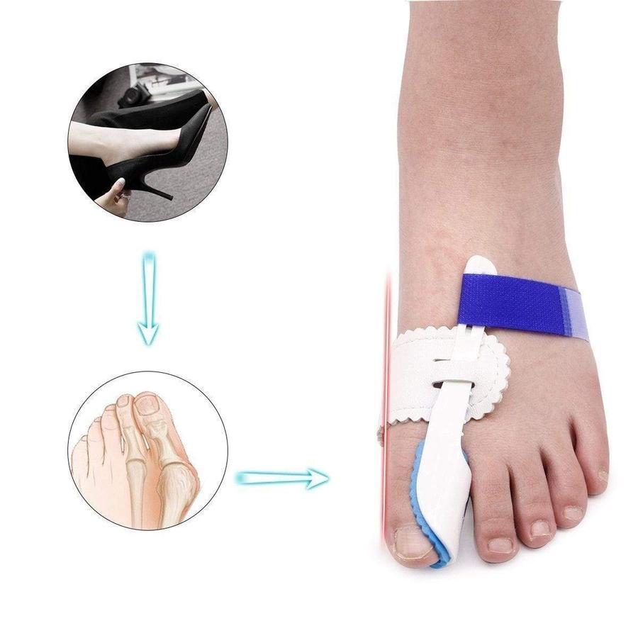 Bunion Corrector Splint: closure detail