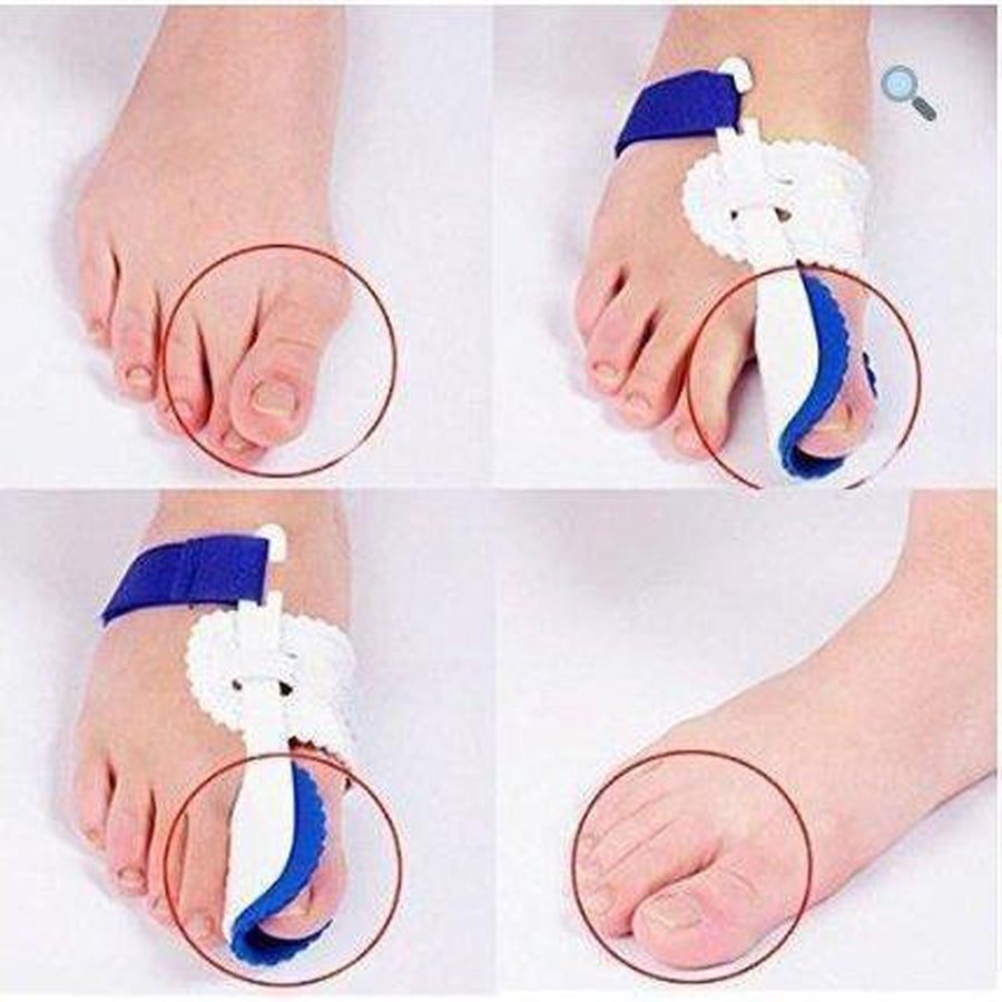 Bunion Corrector Splint: alternate color or angle